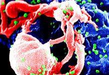 Nárůst HIV se v ČR zastavil. Rizikem dál zůstávají cizinci HIV