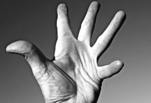 Systémová sklerodermie bývá překvapením i pro lékaře