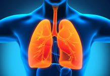 Rakovina plic: Imunoterapii lze předepsat už v první linii