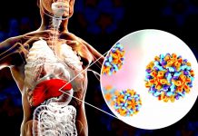 Lékárníci orodují za lepší hygienu. Důvod je žloutenka žloutenka