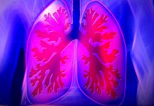 Co dělá Sekce pro intersticiální plicní procesy Sekce pro intersticiální plicní procesy SIPP