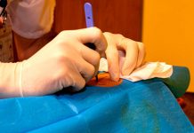 Podkožní senzory pro diabetiky značí průlom v léčbě Podkozni_senzory_pro_diabetiky