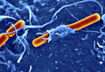 Příčinou úplavice je tyčinkovitá bakterie z rodu Shigella úplavice