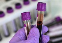 Mnohá léčiva skýtají naději na úspěšnou léčbu covid-19 na_lecbu_covid-19