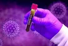 Riziko náhlého vzrůstu počtu pacientů s covid-19 je stálé pacientu_s_covid