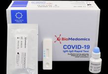 Konec karantény potvrdí až negativní test na protilátky karanteny