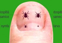 Klíšťová encefalitida je zde. Namístě je očkování encefalitida_w