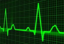 Fibrilace srdečních síní se u nás týká až půl milionu lidí fibrilace