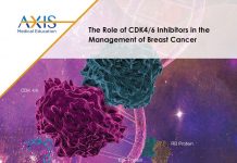 ONKO Unie tlačí na zařazení léků CDK 4/6 do úhrad