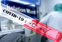 Nařízenou karanténu lze nově ukončit i bez PCR testu bez PCR