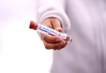 Úpravy statistiky covid pacientů problémy neřeší statistiky_covid_pacientu