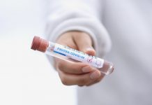 Antigenní testy oproti PCR reagují jen na živé viry antigenni_testy