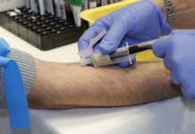 Týden testování nabídne testy na HIV, žloutenku i syfilis syfilis