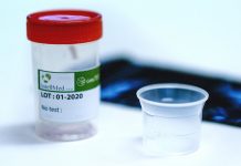 Kloktací test na covid-19 je pohodlný, ale i drahý kloktaci_test