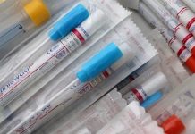 Na antigenní test zdarma mohou pojištěnci každé tři dny antigenni_test