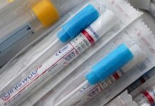 Bezplatný test na koronavirus jednou za tři dny končí bezplatny_test_na_koronavirus