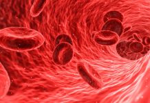 Krevní sraženina po vakcíně AstraZeneca je rizikem krevni_srazenina