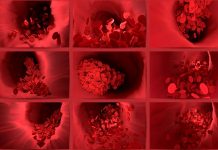 ČSTH dala postup u rizika krevních sraženin u očkování krevnich_srazenin