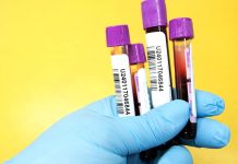 Pozitivní test na protilátky značí 90 dnů uznané imunity test_na_protilatky