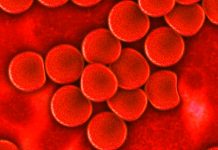 Krvetvorbu u transplantace zvýší oslabení natural killers transplantace