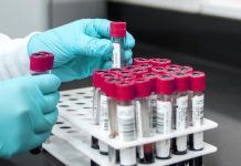 Protilátky se nezačnou uznávat zřejmě ani do konce roku protilatky