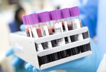 Do studie na protilátky Preval II se lidé sami nepřihlašují na_protilatky_Preval_II