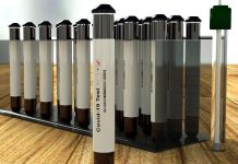 Váznoucí očkování má povzbudit kratší platnost testů