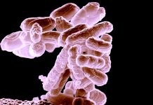 Po deseti letech loni celosvětově vzrostly úmrtí na TBC umrti_na_tbc