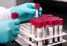 Nádory krve léčí i transplantace vlastních krevních buněk transplantace_vlastnich_bunek