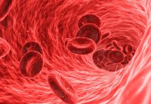 Železo pacientům kardiologové doplňují pomocí infuze zelezo