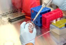 HPV DNA testy snižují riziko rakoviny děložního čípku HPV_DNA_testy