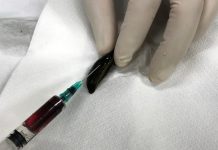 Injekční odběry krve u zvířat zřejmě brzy nahradí pijavky pijavky