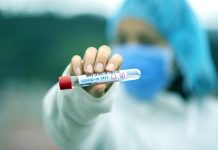 Nejvíce uznaných nemocí z povolání připadá na covid uznanych_nemoci