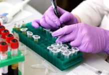 V Česku se potvrdil záškrt, poprvé po 27 letech zaskrt