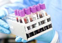 S nákazou HIV se v Česku léčí 308 běženců z Ukrajiny bezencu