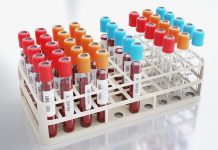 Se žloutenkou se loni léčilo podstatně méně lidí se_zloutenkou