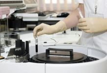 SZÚ v Česku předběžně potvrdil opičí neštovice opici