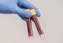 Na „céčko“ testuje i praktik, chce si o to jen říct "cecko"