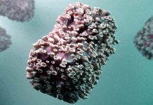 V ČR zemřel první člověk s opičími neštovicemi opicimi