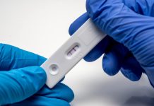 Covid zase nabíhá, ukázala data i potvrdily odbory covid