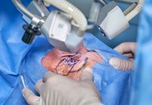 Oční lékaře těžko hledají už i soukromé kliniky ocni