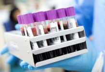 S HIV v Česku pobývá 537 běženců z Ukrajiny bezencu