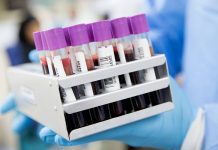 Uměle vypěstovaná krev se testuje už i na lidech umele_krev