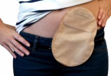 Stomie není konec života, vědí stomičtí pacienti stomie