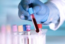 Lékaři tlačí na úhrady AMH testů pro ženy AMH