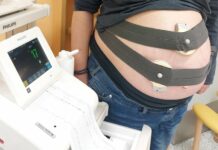 Sokolovská porodnice pořídila moderní CTG pásy CTG_Pasy