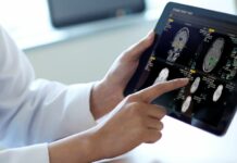 Umělá inteligence se stala součástí moderní diagnostiky Philips