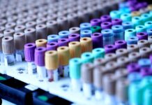 CZEDMA kritizuje novelu o zdravotnických prostředcích Czedma