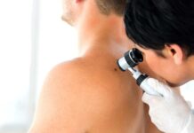 Podezřelých nálezů při Spolu proti melanomu přibylo Spolu_proti_melanomu