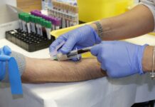 Žloutenka je sedmou nejčastější příčinou úmrtí v Evropě zloutenka